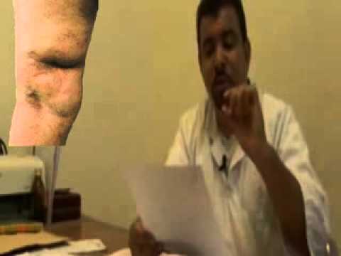 فائزي الجموعي حالة انسانية عاجلة تتطلب العلاج في الخارج لذوي القلوب الرحيمة 