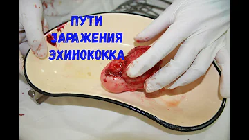 Пути заражения эхинококкозом.