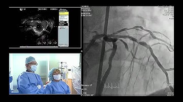 TCTAP 2015 Coronary Theater Live Case Session VI