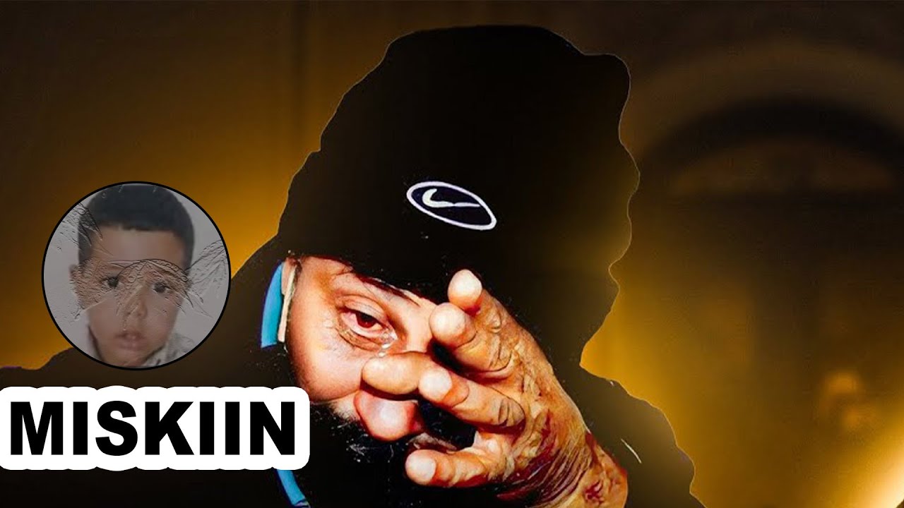 Aabahan Koox dhan Ayaa Cunugiisa Si Xun Udilay  || Qiso Xanuun Badan.