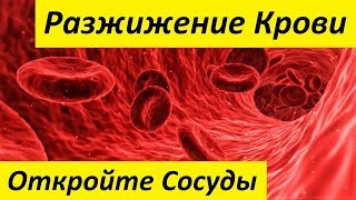 Разжижение Крови. Показания и Продукты для Разжижения Крови