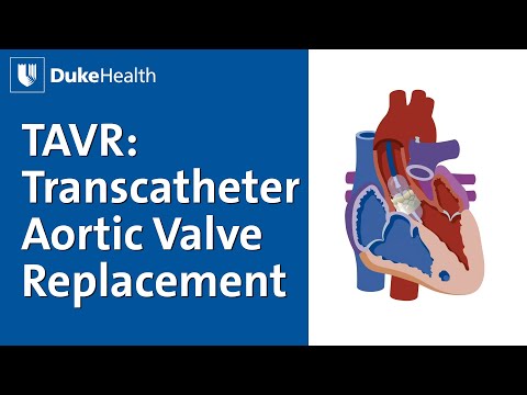 TAVR: Transcatheter Aortic Valve Replacement Explained | Duke Health