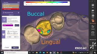 Drawing the finish line and adjusting tooth in exocad