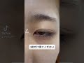#二重整形 #shorts