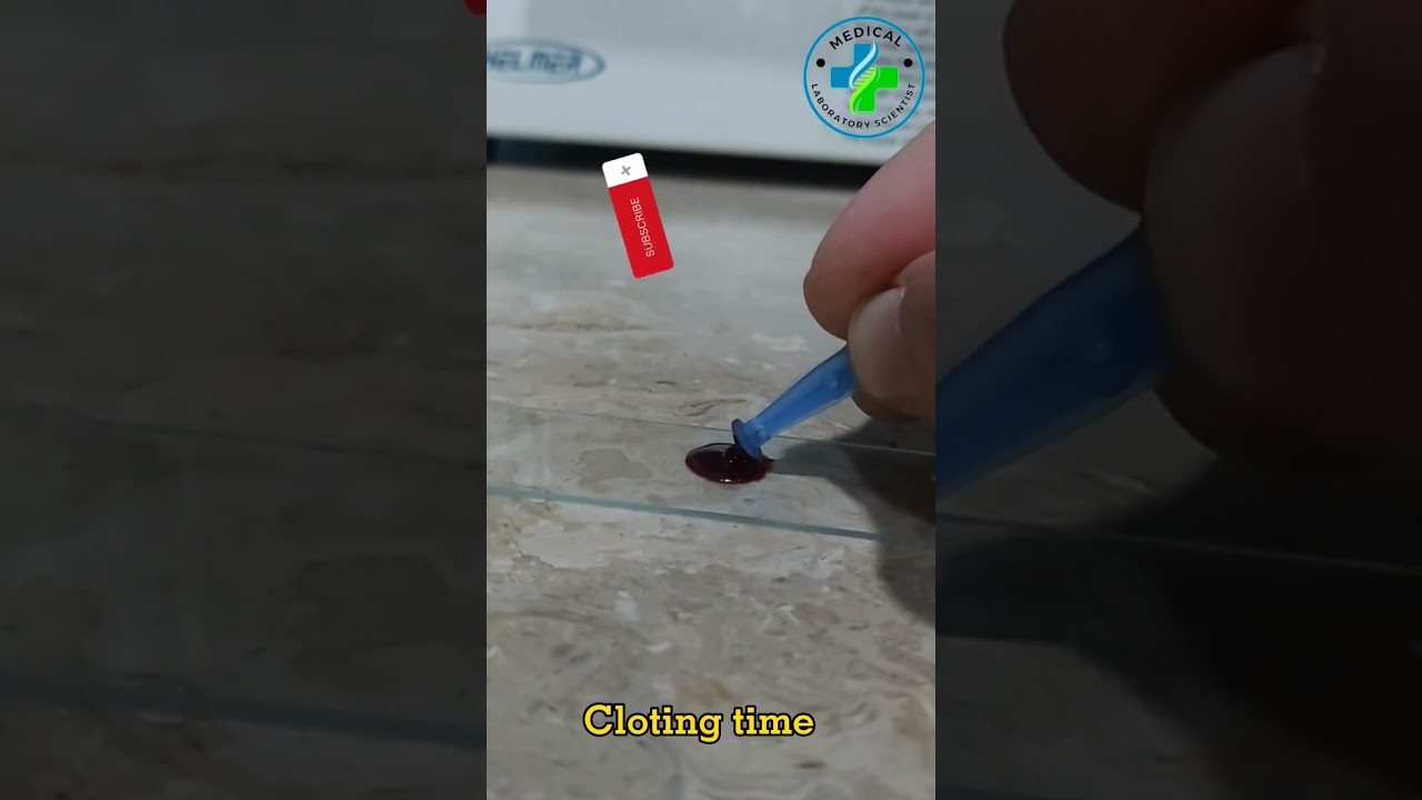 Clotting Time | Blood clotting time determination by slide method | clotting time procedure | CT