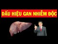 Sáng dậy có dấu hiệu này cảnh báo Gan đang nhiễm độc - SKST