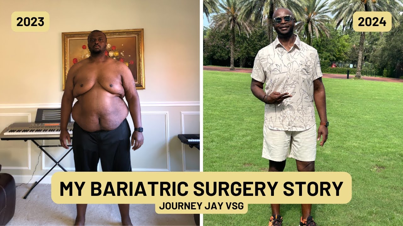 My Bariatric Weight Loss Journey: One Year In…