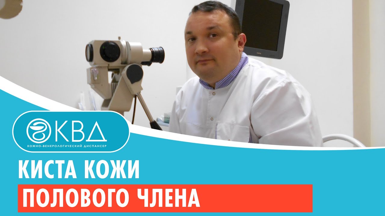 Киста кожи полового члена. Клинический случай №119