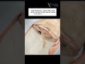 Knee decompression system Excellent for knee pain relief, OA knee #kneereplacement #vidaspineclinic