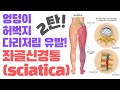 (엉덩이,허벅지통증,다리저림)좌골신경통 해결하는 두번째 이야기!(How to Stop It NOW,Causes Sciatica)