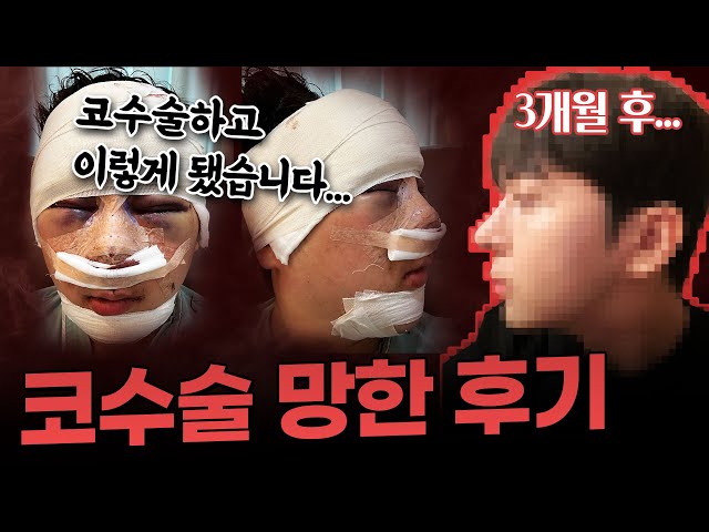 코수술했는데 눈이 안떠져요😫