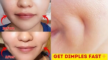How to Get Dimples Naturally in Minutes! 😊
