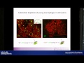 Myelin regeneration and ageing Robin Franklin
