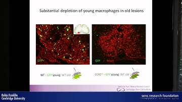 Myelin regeneration and ageing - Robin Franklin