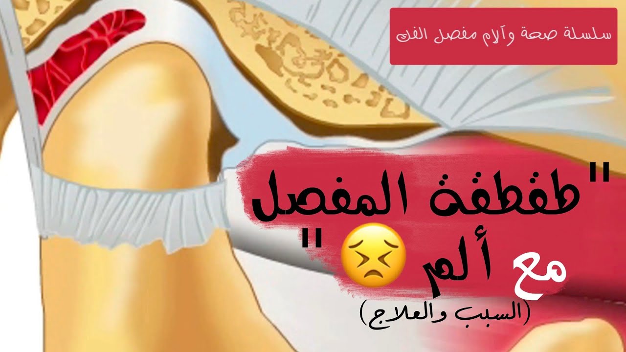 (١٣- طقطقة المفصل مع ألم (الأسباب والعلاج