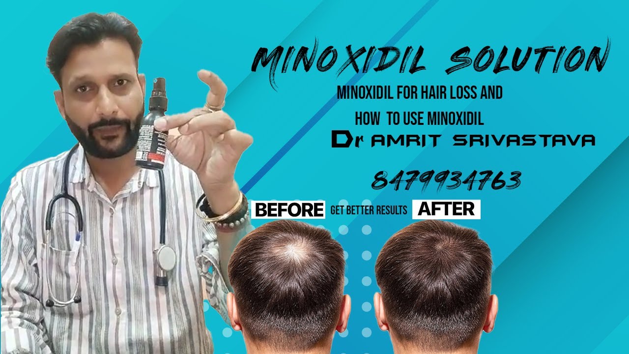 Minoxidil for Hair Loss: What It Is, How to Use It | Dr. Amrit Srivastava (Howrah)
