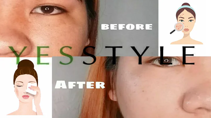 YESSTLYE #CHOOSETOBARE (IWD) ll PHILIPPINES ll NIC...