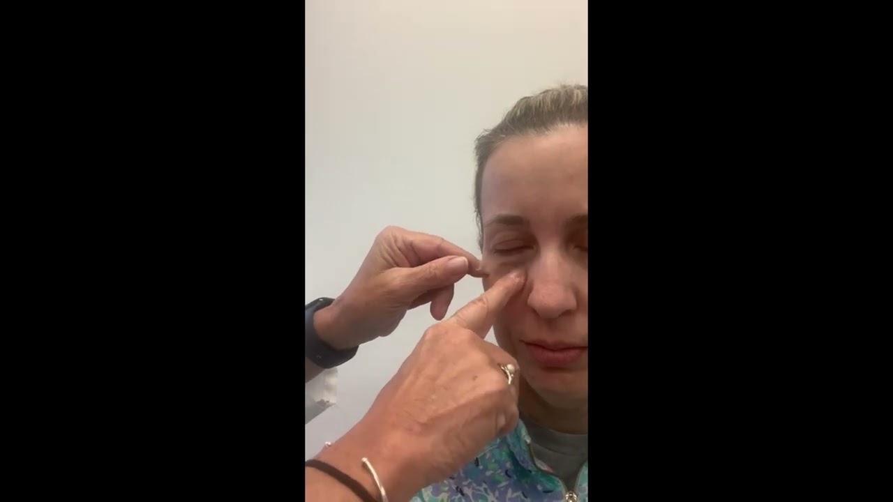 Eye Taping Technique