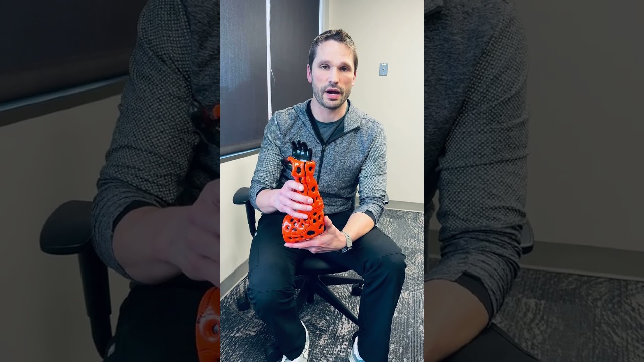 Dr. Jesse Abeler At Bowen Hefley Orthopedics On ActivArmor 3D Printed Casts