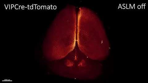 mesoSPIM imaging with and without axially scanned light-sheet excitation (ASLM) in a mouse brain.