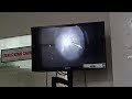 Retina Surgery, Dr Jignesh Gala, Crystal Clear Eye Hospital, Andheri west, +91 7718885245