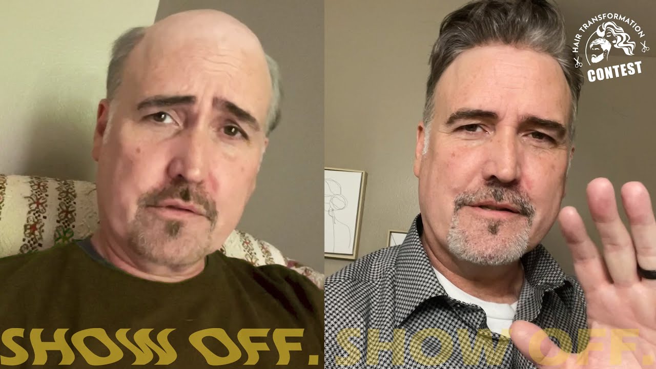 Hairpiece Wearer For 26 Years Gives Advice | Hair Transformation Contest 2022