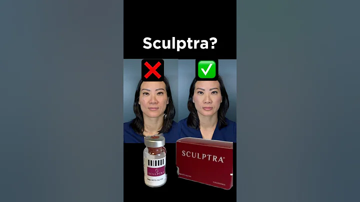 The TRUTH Behind Sculptra #facelift