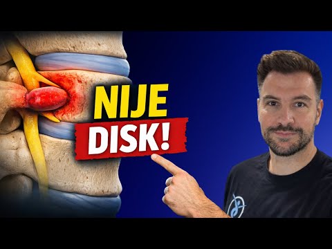 Hernija Diska L5–S1: Rješenje Koje Nitko Nije Očekivao
