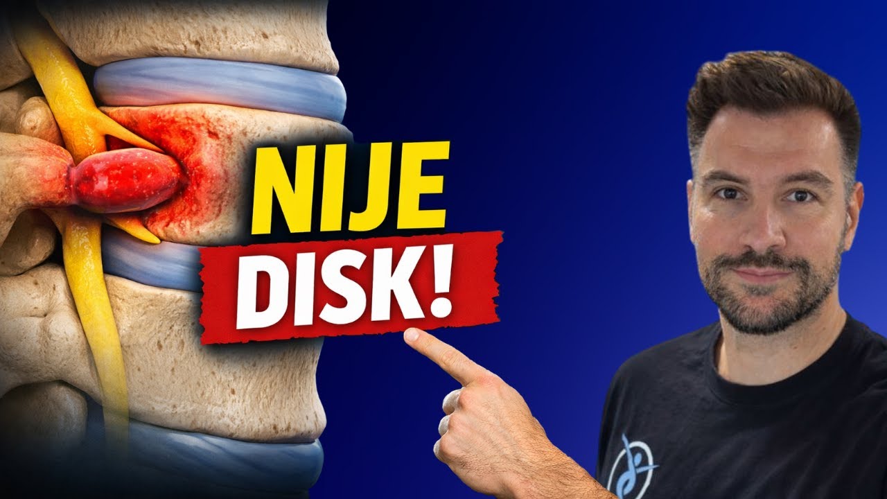 Hernija Diska L5–S1: Rješenje Koje Nitko Nije Očekivao