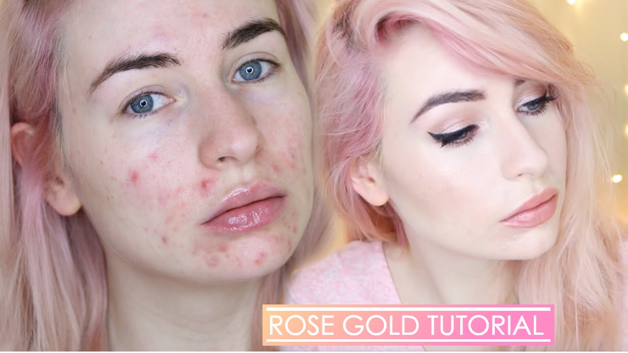 ROSE GOLD MAKEUP TUTORIAL Full Face With Acne YouTube