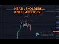 Bitcoin Breaking Head and Shoulders pattern!