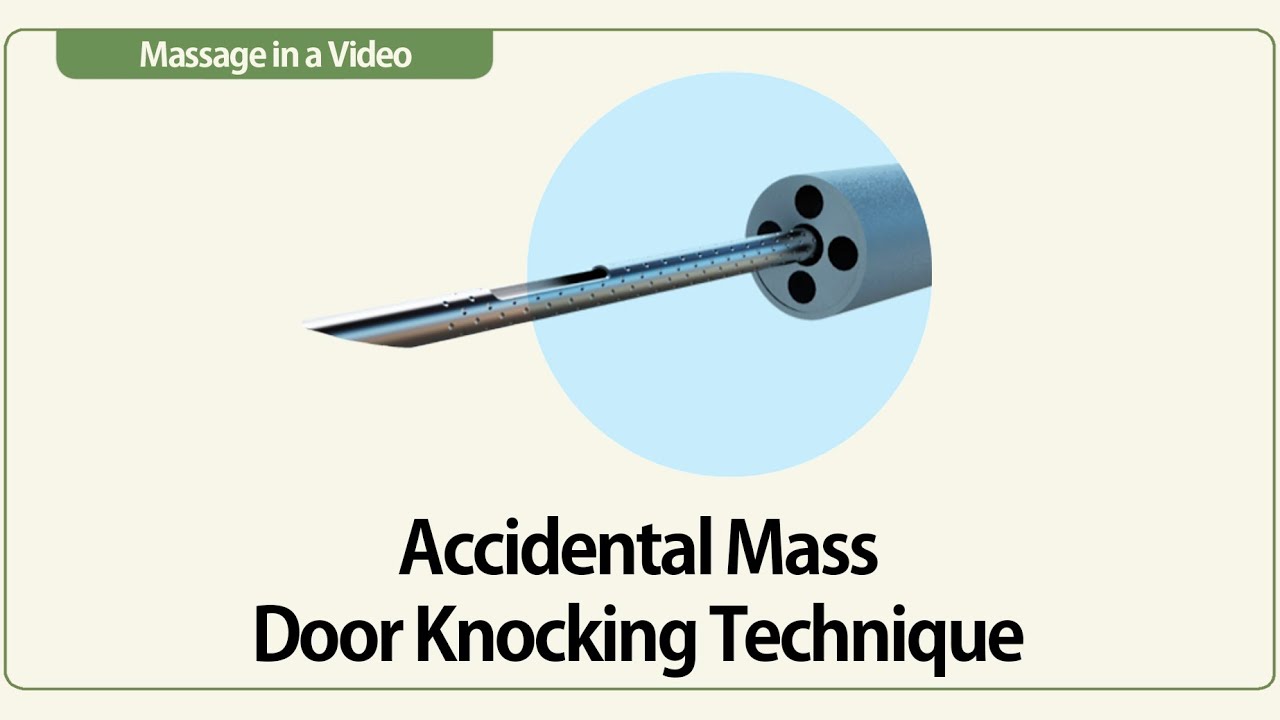 Linear EUS Accidental Mass Door Knocking Technique YouTube