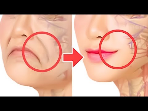 Video: Paano Bawasan ang Mga Wrinkle sa Iyong Mga pisngi: 11 Hakbang (na may Mga Larawan)