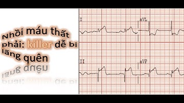 Đọc Điện tâm đồ(ECG): video 8: Nhồi máu cơ tim có ST chênh lên thất phải