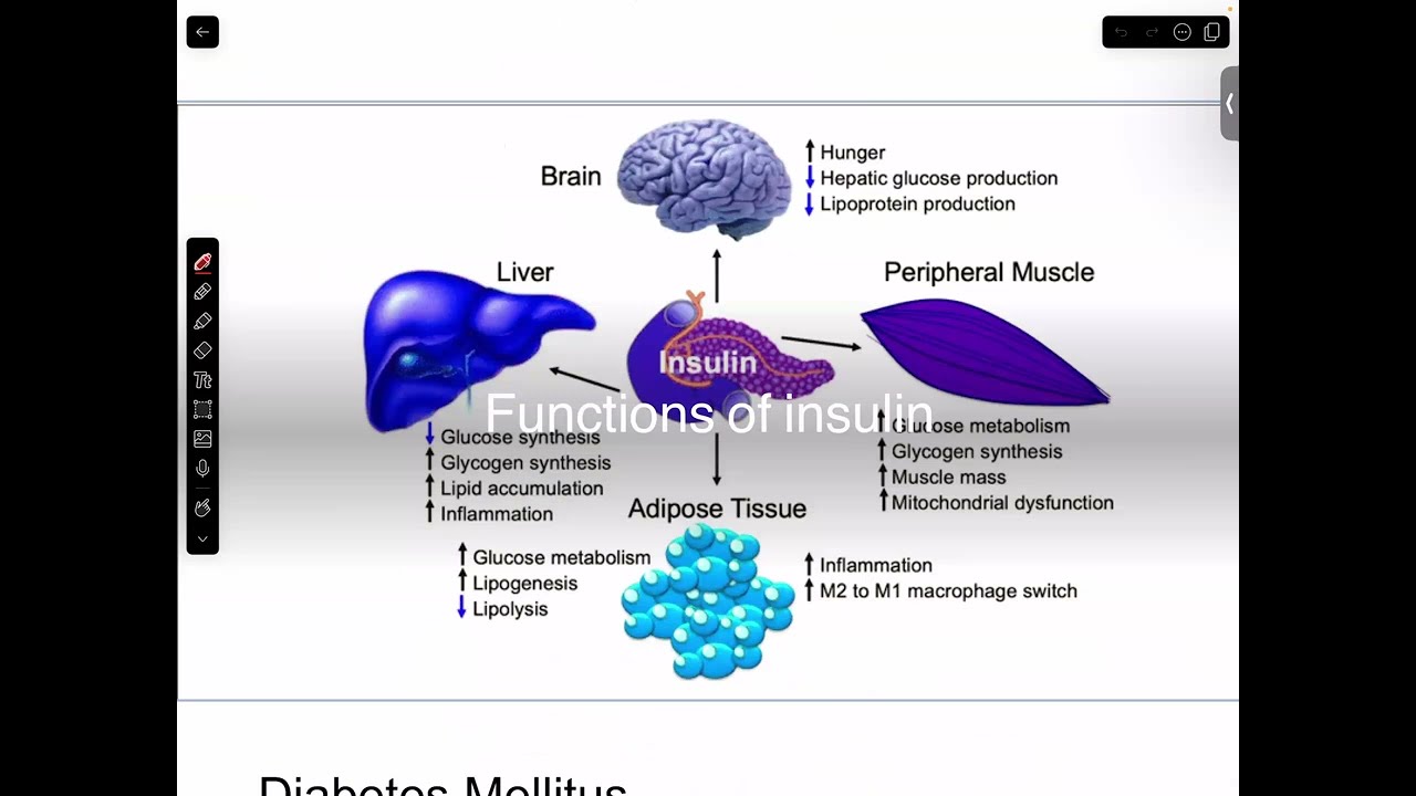 DIABETIC KETOACIDOSIS LECTURE