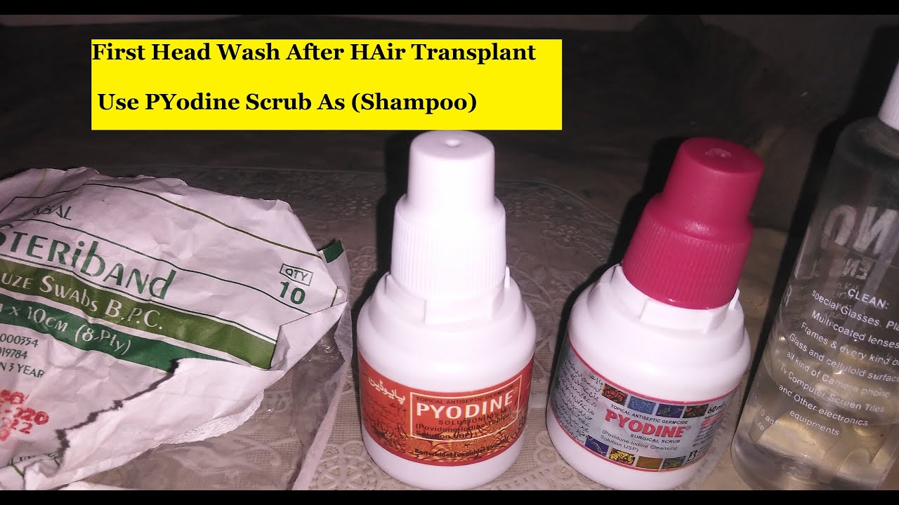 First Head wash After Hair Transplant || Complete Guide || Hair Transplant in Faislabad Pakistan....