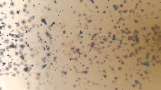 Particle Explosion Intro
