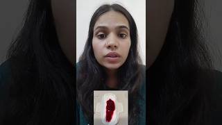 periods ke doran heavy bleeding kyo hoti hai? #ayurveda #periods #health #menstrualbleeding