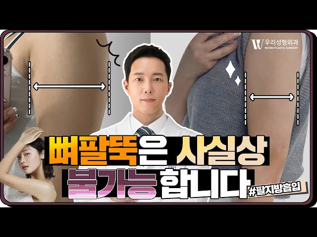 뼈팔뚝 사실상 불가능합니다! #팔지방흡입