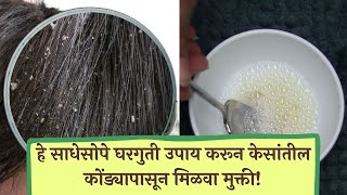 हे साधेसोपे घरगुती उपाय करून केसांतील कोंड्यापासून मिळवा मुक्ती | Dandruff Home Remedies |