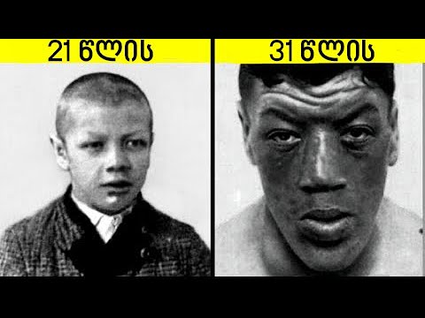 ეს ადამიანი ჯუჯაც იყო და გიგანტიც