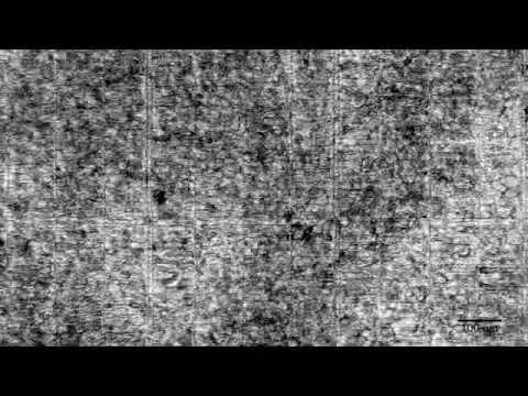 Beating Cardiac Patch