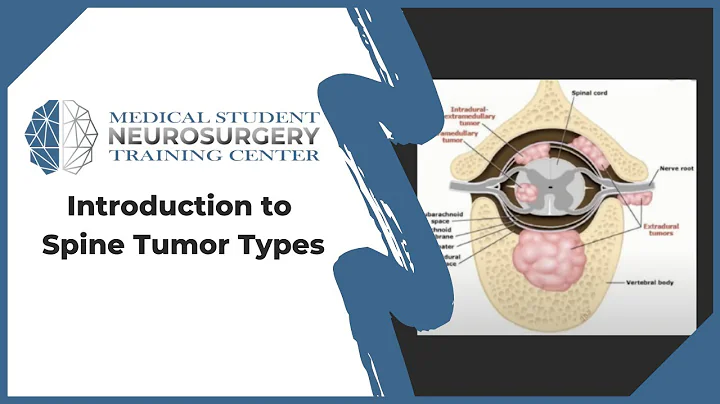 Introduction to Spine Tumor Types