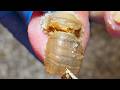 Toenails Have Extra Thick Shells That Are Removed From The Root【Xue Yidao】