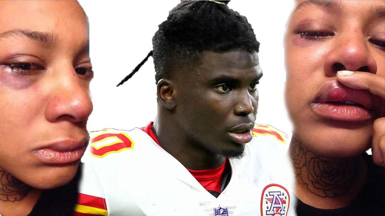 KCTV5 responds to criticism about releasing only a portion of Tyreek Hill recording