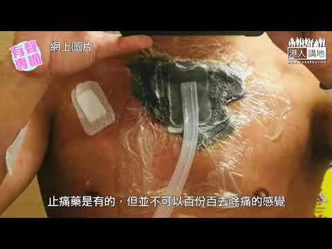 【短片】【有聲專欄】被潑腐液受傷 衝鋒警自白：一陣風吹過都會劇痛、冀康復時香港已回復太平