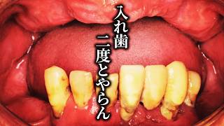 入れ歯を使い始めてから生活が激変静かに奪われていった骨と笑顔を奪還せよ編