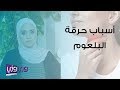 أسباب حرقة البلعوم وعلاجه 