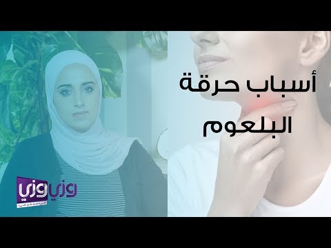 أسباب حرقة البلعوم وعلاجه