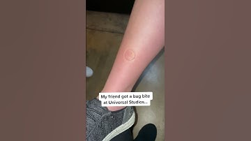 Watch the full video to hear their reaction - woah! 💚 #itsathing #bugbitething #bugbiterelief